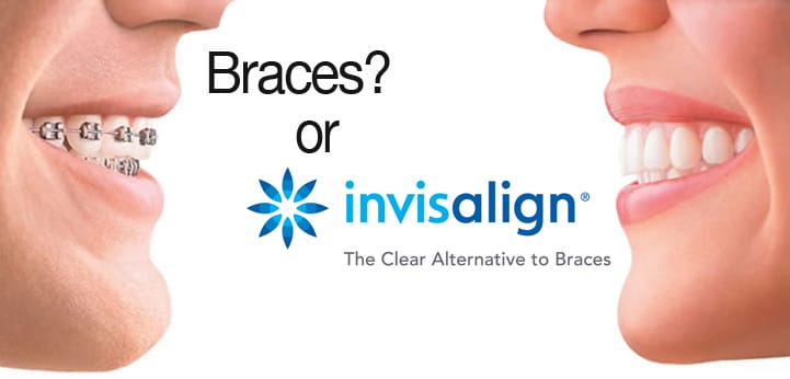 braces or invisalign-kristen ritzau dds