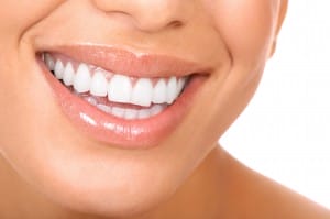 Kristen Ritzau Teeth Whitening San Clemente Kristen Ritzau Teeth Whitening San Clemente